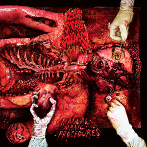 200 STAB WOUNDS - Manual Manic Procedures - CD